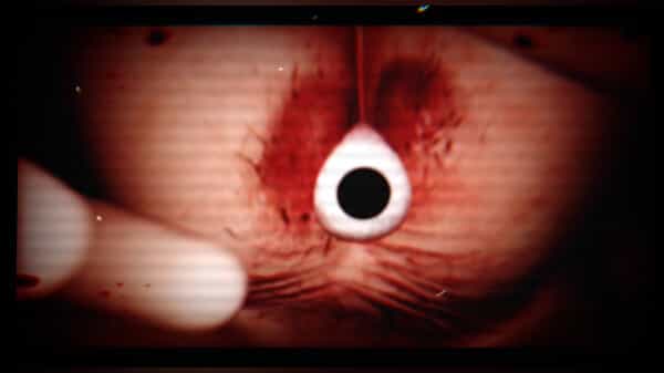 shirime-the-curse-of-butt-eye